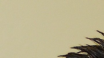 Luis Camarillo, de 44 años, recibe diálisis  mientras está a la espera de un trasplante de riñón que le permita seguir con vida.