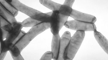 La legionella es una bacteria que se encuentra naturalmente en ambientes de agua dulce y puede causar la enfermedad del legionario. Foto CDC