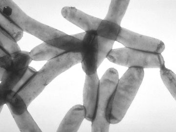 La legionella es una bacteria que se encuentra naturalmente en ambientes de agua dulce y puede causar la enfermedad del legionario. Foto CDC