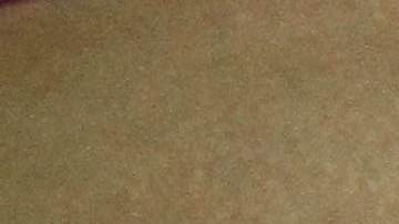 El cirujano general pidió a las embarazadas que se cuiden del zika.