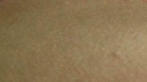 El cirujano general pidió a las embarazadas que se cuiden del zika.