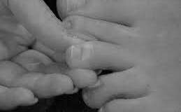 Una infección tras una pedicura se extendió a los huesos y la víctima debió someterse a cirugía.