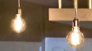 Shakira tiene una hemorragia en sus cuerdas vocales.