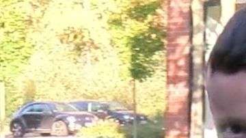 Hassan tiene piel de mariposa desde que tenía apenas unos días de vida.