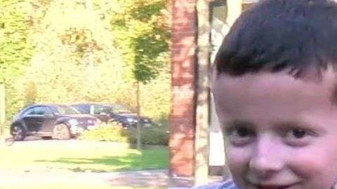 Hassan tiene piel de mariposa desde que tenía apenas unos días de vida.