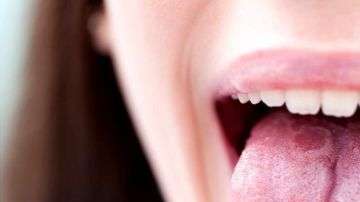 La afección suele cambiar de forma y de ubicación.