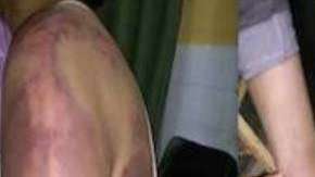 El hombre golpeó a su pareja en todo su cuerpo.