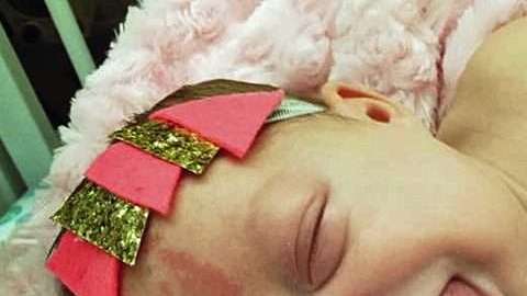 Paisley Morrison-Johnson, nación con el síndrome de Beckwith Wiedemann.