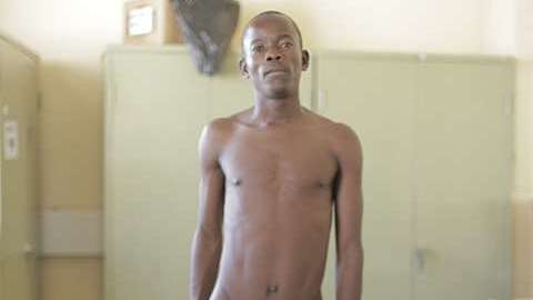 Un vecino le tomó fotos a Horace para que se viralizaran en Facebook y llegara su caso a los médicos indicados.