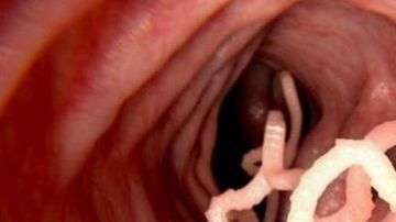 Las tenias y lombrices pueden llegar al intestino al ingerir alimentos contaminados mal cocidos fertilizados con heces no tratadas.