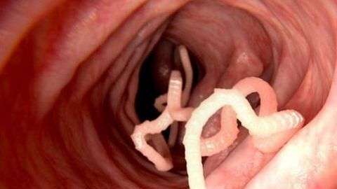 Las tenias y lombrices pueden llegar al intestino al ingerir alimentos contaminados mal cocidos fertilizados con heces no tratadas.