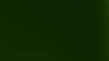 Los pelos en el cuerpo de las moscas atraen bacterias.