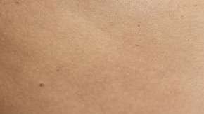 Los avances médicos ayudarían en el proceso.