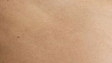 Los avances médicos ayudarían en el proceso.