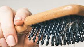 Para las mujeres, la caída excesiva de cabello daña su autoestima.