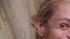 Zoey Tidwell tendrá que someterse a cirugía desde ahora hasta los 18 años cada seis meses.