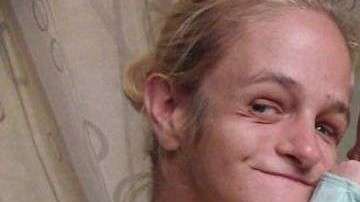 Zoey Tidwell tendrá que someterse a cirugía desde ahora hasta los 18 años cada seis meses.