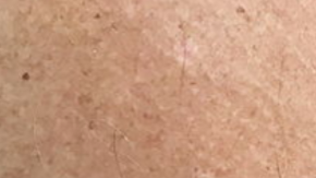 Este tatuaje ocasionó un debate ético.