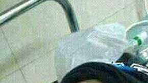 El menor murió, aproximadamente, 12 horas después de la mordida.