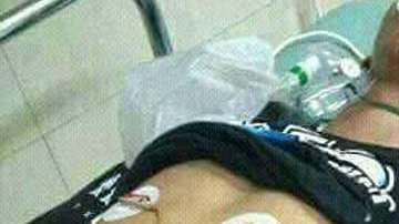 El menor murió, aproximadamente, 12 horas después de la mordida.