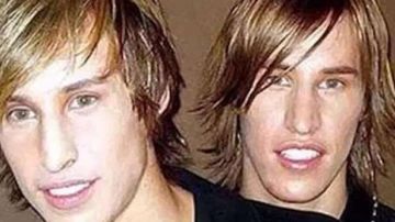 Estos gemelos aseguran ser iguales a Brad Pitt.