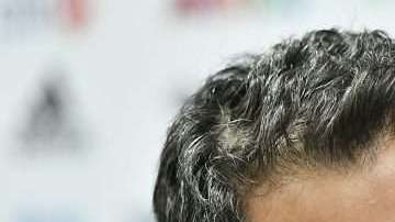 Juan Carlos Osorio, adelanta que su carro está casi completo para emprender el camino a Rusia. (Foto: Imago7/Etzel Espinosa)