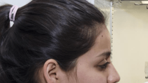 La biopelícula ayudará a la regeneración del tejido epitelial, informó hoy el Consejo Nacional de Ciencia y Tecnología (Conacyt)