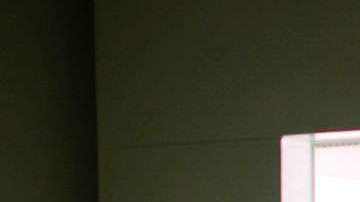 La distrofia muscular está vinculada a una mutación en el cromosoma X.