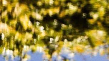 Shakira está convaleciente.