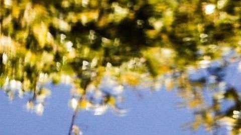 Shakira está convaleciente.