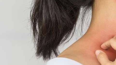 La comezón puede ser señal de algo peor.