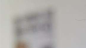 El maquillaje es básico para disimular las manchas blancas.