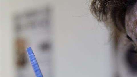 El maquillaje es básico para disimular las manchas blancas.