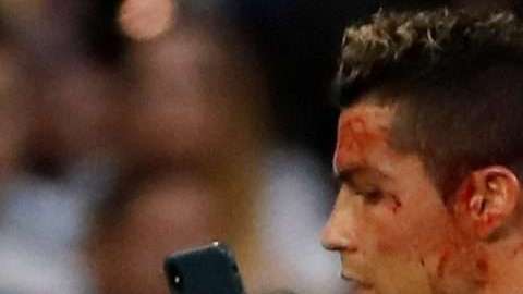 El delantero portugués del Real Madrid, Cristiano Ronaldo bañado en sangre. (Foto: EFE/ Juan Carlos Hidalgo)
