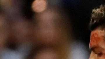 Cristiano Ronaldo bañado en sangre. EFE/ Juan Carlos Hidalgo