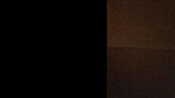 Un niño de 13 años se clava un tornillo. Afortunadamente, se salvó de morir.