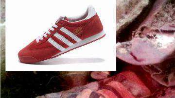 El calzando de la momia se parece a unos tenis Adidas.