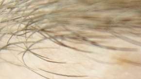 La posibilidad de error es mínima.