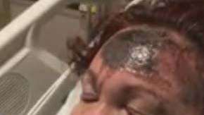 Se desconoce por qué la mujer se quemó el rostro.