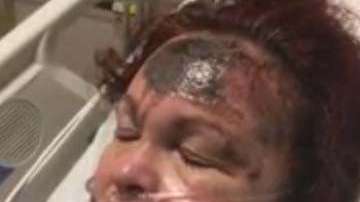 Se desconoce por qué la mujer se quemó el rostro.