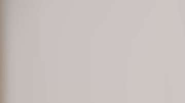 Franck Ribery recibió comentarios muy crueles por su cicatriz