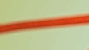 Algunos cambios en tu vida pueden librarte de padecer este mal.