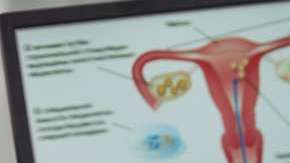 La citología cervical se recomienda anualmente a mujeres mayores de 21 años.