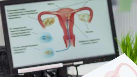 La citología cervical se recomienda anualmente a mujeres mayores de 21 años.