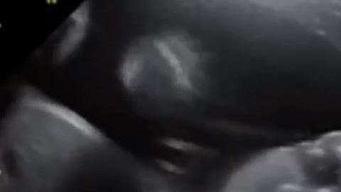 Este bebé les dio una grata sorpresa a sus padres.