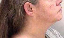 Melinda Dillashaw no negó las acusaciones de intentar castrar a su novio en Georgia