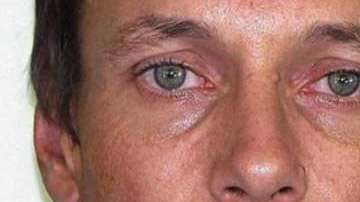 Brett Peter Cowan (en la foto) fue atacado con agua caliente.
