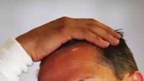 Michael Schumacher sufrió un accidente el 29 de diciembre de 2013, mientras esquiaba en los Alpes franceses