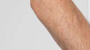 Hay varias señales que te indican que hay una infección en tu miembro.