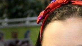 Errin empezó a rechazar la comida tras sufrir una reacción alérgica cuando era bebé.